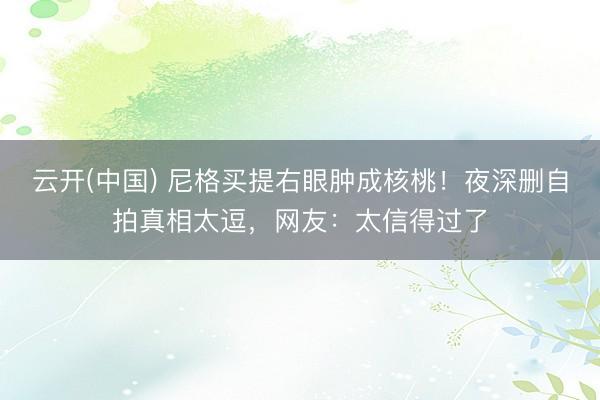 云开(中国) 尼格买提右眼肿成核桃！夜深删自拍真相太逗，网友：太信得过了
